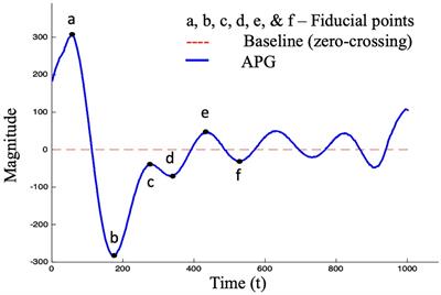 Machine learning approaches for cardiovascular hypertension stage estimation using photoplethysmography and clinical features